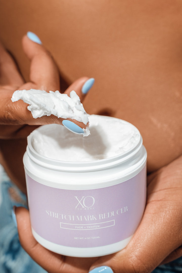 XO Stretch-Mark Reducer
